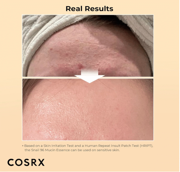 Cosrx, Advanced Snail 96 Mucin Power Essence , 3.38 Fl Oz (100 ml) - Image 4