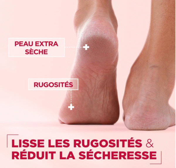 Mixa Expert Peau Sensible - Pommade Ultra-Réparatrice Cica Réparation 10-en-1 - Peaux Extra Sèches et Rugosités - Pieds, Genoux, Mains, Coudes - 100H d'Hydratation - Hypoallergénique - 150 ml - Image 4