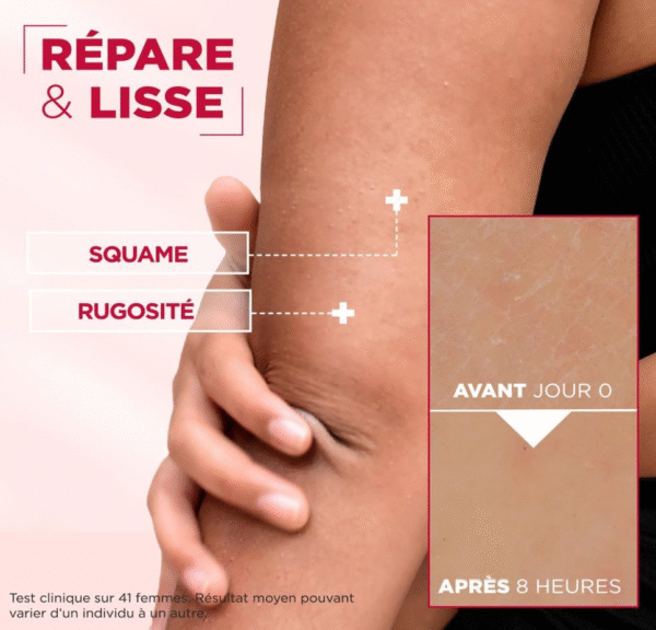 Mixa Crème Cica Réparation - Expert Peau Sensible - Réparation Effet Longue Durée - Peaux Très Sèches et Rugueuses - Visage, Corps, Mains - Hypoallergénique - 400ml - Image 3