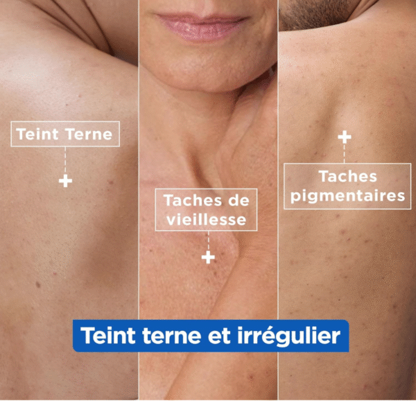 Mixa - Crème Hydratante Anti-Taches au Beurre de Karité, à la Niacinamide et à la Vitamine C - Adaptée au Visage, Corps et Mains - Hypoallergénique - 400ml - Image 4