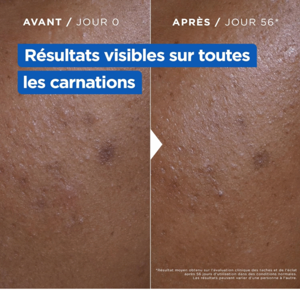 Mixa - Crème Hydratante Anti-Taches au Beurre de Karité, à la Niacinamide et à la Vitamine C - Adaptée au Visage, Corps et Mains - Hypoallergénique - 400ml - Image 6